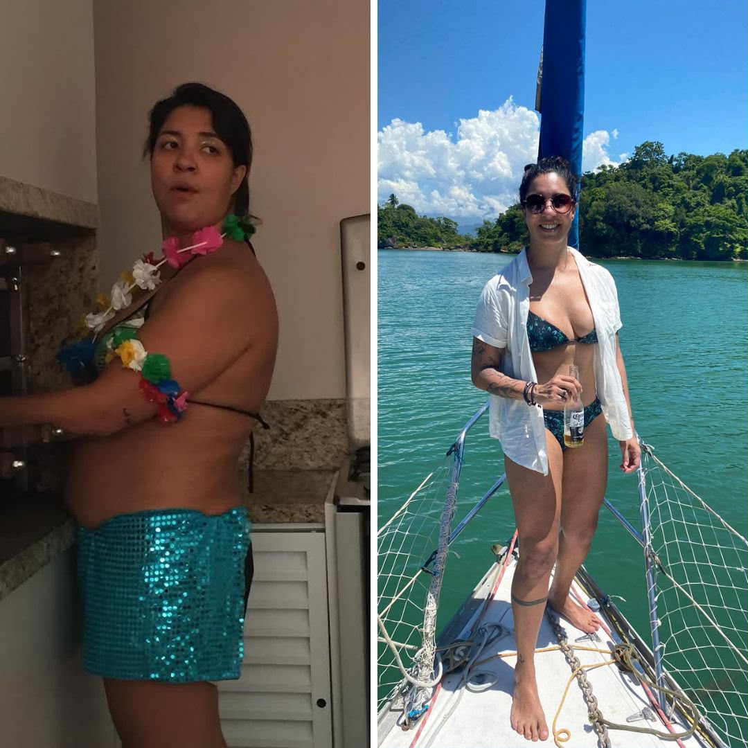 Antes e depois, caso 3