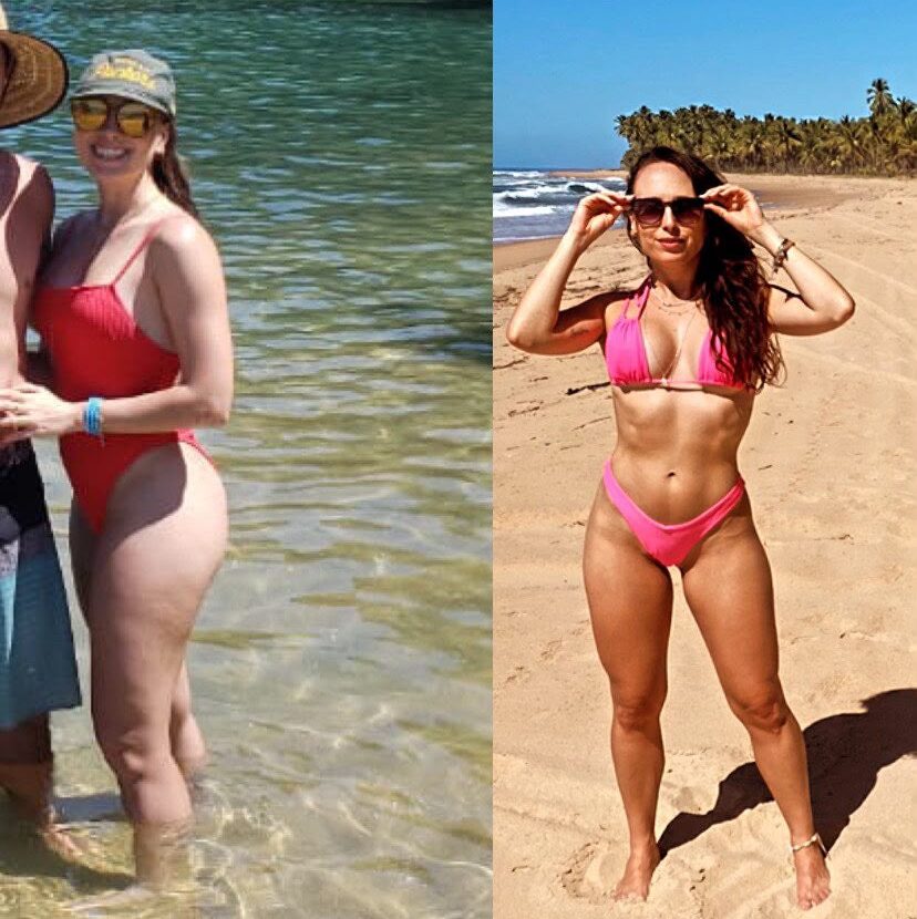 Antes e depois, caso 4